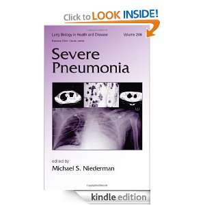 Severe Pneumonia (Lung Biology in Health and Disease) Michael S 