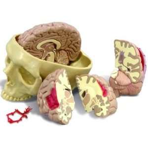 Diseased Human Brain in Skull Anatomy Model #2900  